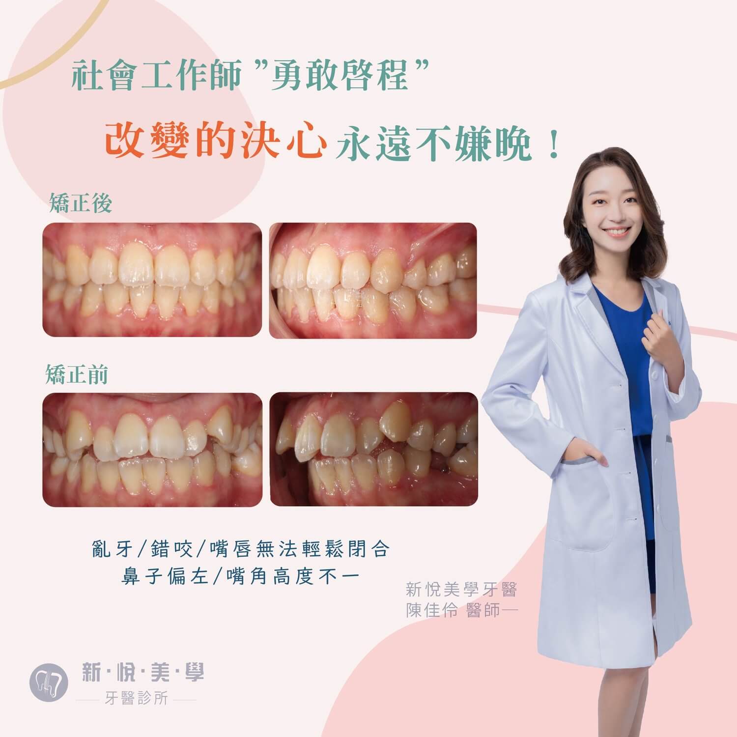 新悅美學牙醫診所的案例分享圖片